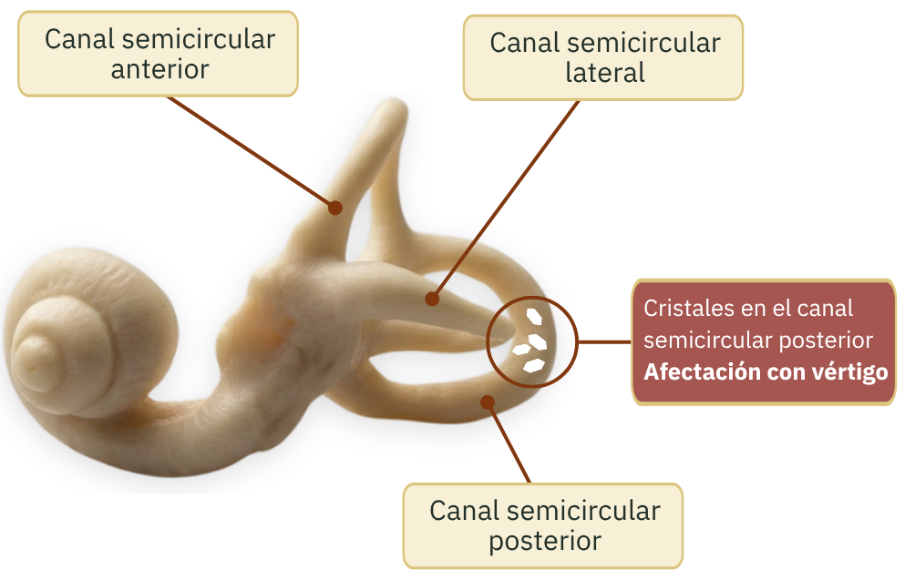 Esquema del sistema vestibular y los canales semicirculares